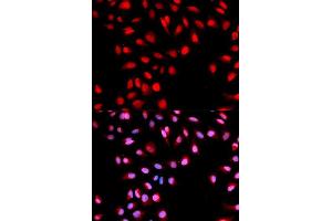 Immunofluorescence analysis of U2OS cells using Phospho-MET-Y1003 antibody (ABIN5969921). (c-MET antibody  (pTyr1003))