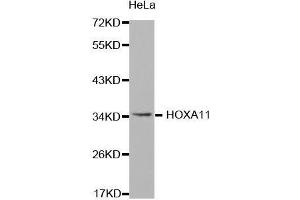 Western Blotting (WB) image for anti-Homeobox A11 (HOXA11) (AA 1-180) antibody (ABIN1680330) (Homeobox A11 antibody  (AA 1-180))
