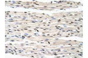 HNRPDL antibody was used for immunohistochemistry at a concentration of 4-8 ug/ml to stain Skeletal muscle cells (arrows) in Human Muscle. (HNRPDL antibody  (Middle Region))