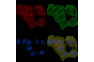 ABIN6263727 and ABIN6272622 staining Hela cells(24h of starvation treatment) by IF/ICC. (NRBP1 antibody  (Internal Region))