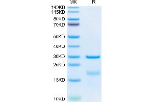 Hepsin Protein (HPN) (AA 45-417) (His tag)