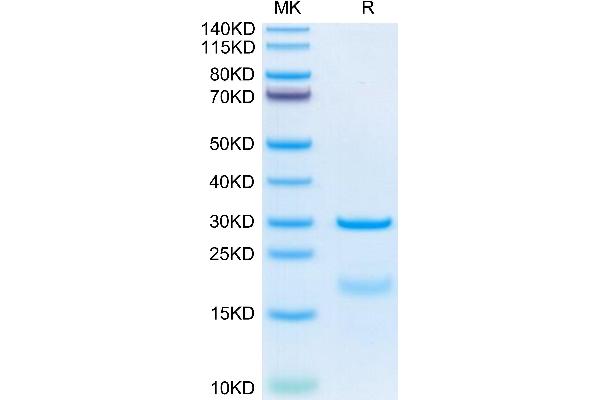 Hepsin Protein (HPN) (AA 45-417) (His tag)