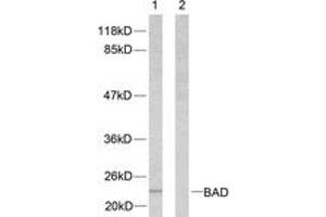 Western blot analysis of extracts from 293 cells, treated with Forskolin, using BAD (Ab-112) Antibody. (BAD antibody  (AA 78-127))