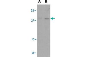Western blot analysis of BAK1 in L1210 cell lysates with BAK1 polyclonal antibody  at (A) 1 and (B) 2 ug/mL . (BAK1 antibody  (N-Term))