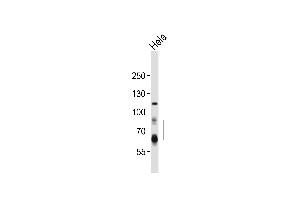 Western Blotting (WB) image for anti-Proprotein Convertase Subtilisin/kexin Type 9 (PCSK9) (AA 153-183), (N-Term) antibody (ABIN652320)