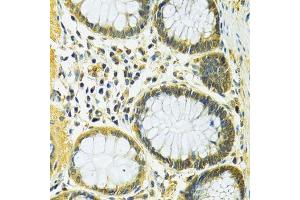 Immunohistochemistry of paraffin-embedded human colon using SLC25A1 antibody. (Slc25a1 antibody  (AA 1-311))