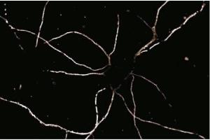 Immunofluorescence staining of rat neurons. (Striatin antibody  (AA 450-600))