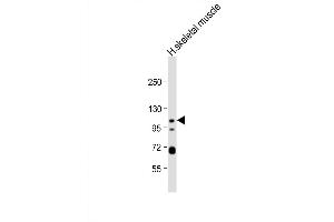 Western Blot at 1:1000 dilution + human skeletal muscle lysate Lysates/proteins at 20 ug per lane.