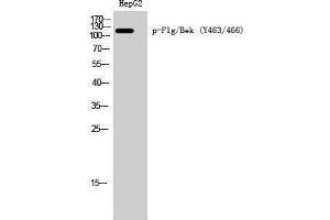 Western Blotting (WB) image for anti-FGFR1, FGFR2 (pTyr463), (pTyr466) antibody (ABIN3182346) (FGFR1/FGFR2 antibody  (pTyr463, pTyr466))
