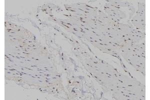 ABIN6266721 at 1/100 staining Human gastric tissue by IHC-P.