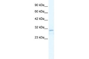 TRPM3 antibody used at 2.