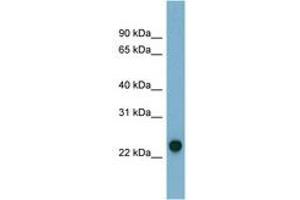 Image no. 1 for anti-Adenylate Kinase 3 (AK3) (N-Term) antibody (ABIN6741718) (Adenylate Kinase 3 antibody  (N-Term))