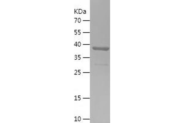 TMED9 Protein (AA 43-202) (His-IF2DI Tag)