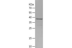 Western Blotting (WB) image for Transmembrane Emp24 Protein Transport Domain Containing 9 (TMED9) (AA 43-202) protein (His-IF2DI Tag) (ABIN7125476)