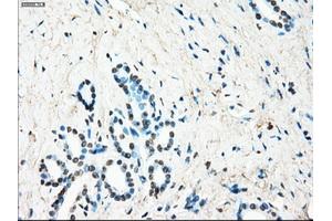 Immunohistochemical staining of paraffin-embedded Ovary tissue using anti-LTA4H mouse monoclonal antibody.