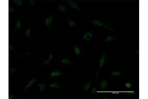 Immunofluorescence (IF) image for anti-Transcription Termination Factor, RNA Polymerase II (TTF2) (AA 2-100) antibody (ABIN521915)