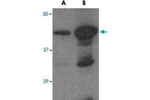 Western blot analysis of (A) 5 ng and (B) 25 ng of recombinant HA1 with Avian Influenza Hemagglutinin 2 polyclonal antibody  at 1 ug/mL . (Hemagglutinin antibody  (N-Term))
