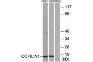 Western blot analysis of extracts from COLO205/293 cells, using Cofilin (Ab-3) Antibody. (Cofilin antibody  (AA 1-50))