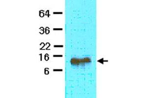 The extract of mouse heart (40 ug) was resolved by SDS-PAGE and probed with FABP4 monoclonal antibody, clone 3F4  (1:500). (FABP4 antibody  (AA 1-132))