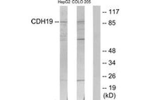 Western blot analysis of extracts from HepG2/COLO205 cells, using CDH19 Antibody. (CDH19 antibody  (AA 371-420))