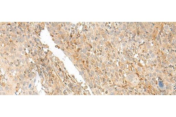 Golgi Integral Membrane Protein 4 (GOLIM4) antibody