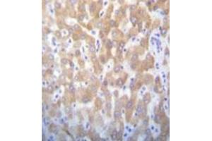 Formalin fixed and paraffin embedded human liver tissue reacted with FAST kinase (C-term) Antibody (C-term) Cat.