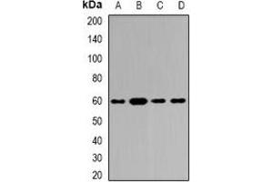 Western blot analysis of Tyrosyl-tRNA Synthetase expression in Hela (A), SKOV3 (B), mouse brain (C), rat brain (D) whole cell lysates. (YARS antibody)