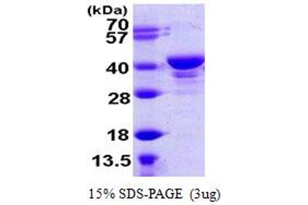 UCHL5 Protein (AA 1-329) (His tag)