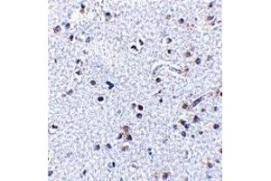 Immunohistochemistry (IHC) image for anti-Thymic Stromal Lymphopoietin (TSLP) (C-Term) antibody (ABIN1030782) (Thymic Stromal Lymphopoietin antibody  (C-Term))