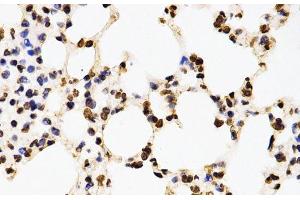 Immunohistochemistry of paraffin-embedded Mouse lung using Asymmetric DiMethyl-Histone H3-R17 Polyclonal Antibody at dilution of 1:200 (40x lens). (Histone 3 antibody  (H3R17me2a))