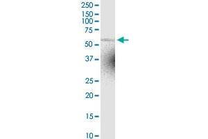 ZNF238 MaxPab rabbit polyclonal antibody. (ZNF238 antibody  (AA 1-522))