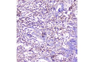 IHC analysis of ADA using anti-ADA antibody (ABIN6719272).