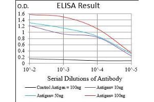 Black line: Control Antigen (100 ng), Purple line: Antigen(10 ng), Blue line: Antigen (50 ng), Red line: Antigen (100 ng), (CTNNBL1 antibody  (AA 390-557))