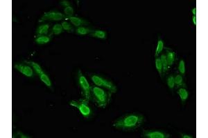 Immunofluorescent analysis of Hela cells using ABIN7152561 at dilution of 1:100 and Alexa Fluor 488-congugated AffiniPure Goat Anti-Rabbit IgG(H+L) (BRIP1 antibody  (AA 66-243))