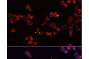 Immunofluorescence analysis of HeLa cells using SLC25A4 Polyclonal Antibody at dilution of 1:100 (40x lens). (SLC25A4 antibody)