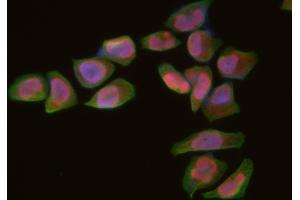 ABIN6266313 and ABIN6277430 staining Hela cells by IF/ICC. (RAD52 antibody  (Internal Region))