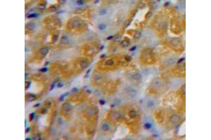Used in DAB staining on fromalin fixed paraffin-embedded Kidney tissue (Calreticulin antibody  (AA 196-310))
