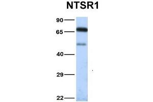Host:  Rabbit  Target Name:  NTSR1  Sample Type:  Human Fetal Heart  Antibody Dilution:  1. (NTSR1 antibody  (N-Term))