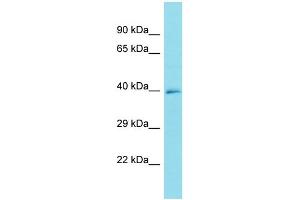 Host: Rabbit Target Name: FRMD6-AS1 Sample Type: U937 Whole Cell lysates Antibody Dilution: 1.