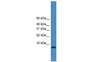 WB Suggested Anti-KIAA0101  Antibody Titration: 0. (KIAA0101 antibody  (N-Term))