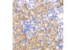 Immunohistochemistry of paraffin-embedded rat kidney using HPD antibody. (HPD antibody  (AA 1-393))