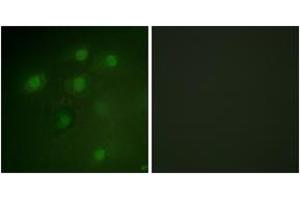 Immunofluorescence analysis of HeLa cells, using PDCD4 (Ab-457) Antibody. (PDCD4 antibody  (AA 420-469))