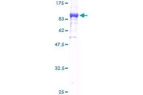 KARS Protein (AA 1-597) (GST tag)