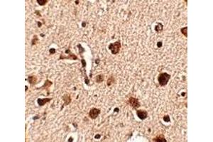 Immunohistochemistry (IHC) image for anti-SLIT and NTRK-Like Family, Member 4 (SLITRK4) (C-Term) antibody (ABIN1030684) (SLITRK4 antibody  (C-Term))
