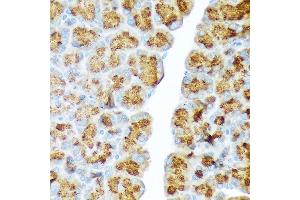 Immunohistochemistry of paraffin-embedded rat pancreas using CTRL Rabbit mAb (ABIN7266395) at dilution of 1:100 (40x lens). (Chymotrypsin antibody)