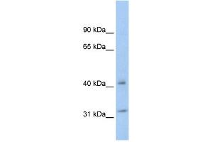 YWHAQ antibody (70R-10463) used at 0. (14-3-3 theta antibody  (N-Term))