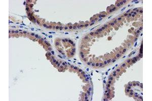 Immunohistochemical staining of paraffin-embedded Human breast tissue using anti-LECT2 mouse monoclonal antibody. (LECT2 antibody  (AA 19-151))