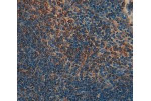 Used in DAB staining on fromalin fixed paraffin- embedded spleen tissue (SKAP1 antibody  (AA 1-355))