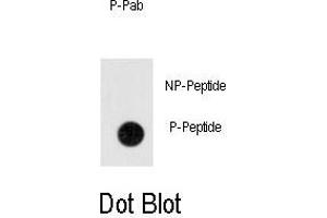 Dot blot analysis of anti-Phospho-ANTXR1-p Antibody (ABIN389930 and ABIN2839748) on nitrocellulose membrane. (ANTXR1 antibody  (pTyr382))