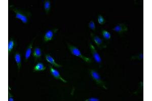 Immunofluorescent analysis of Hela cells using ABIN7168248 at dilution of 1:100 and Alexa Fluor 488-congugated AffiniPure Goat Anti-Rabbit IgG(H+L) (RNF148 antibody  (AA 208-305))